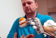 High Tech Handprothese bringt das Fühlen zurück