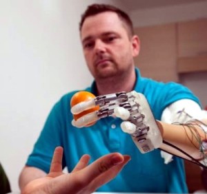 High Tech Handprothese bringt das Fühlen zurück